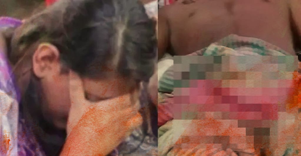 ঘুমন্ত স্বামীর গোপনাঙ্গ কেটে নিল স্ত্রী!